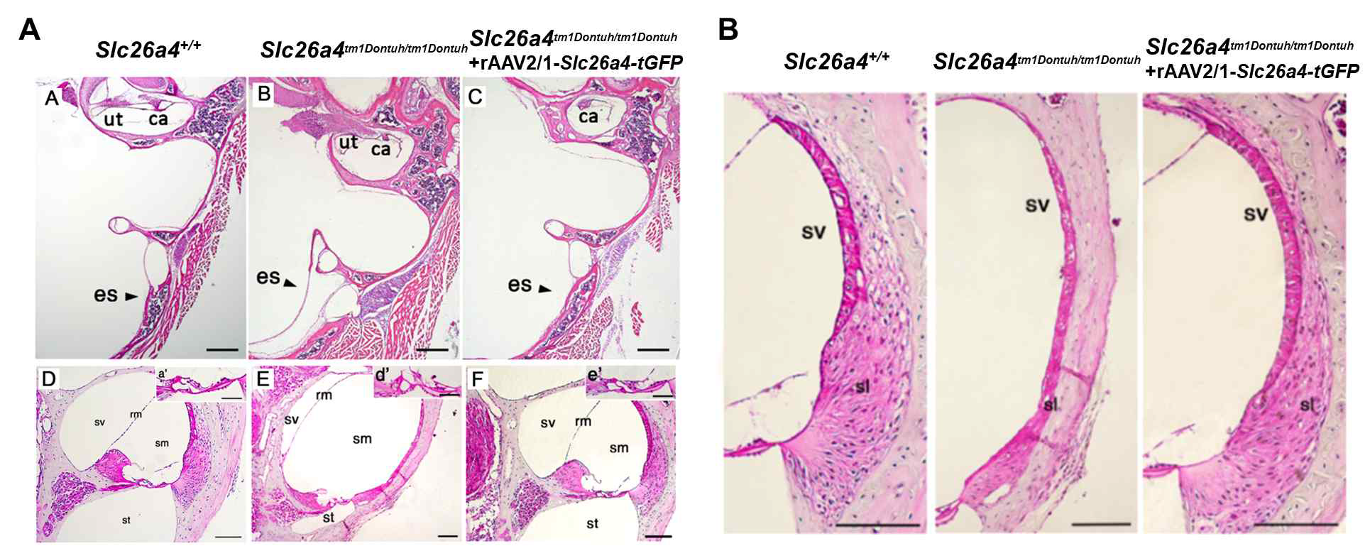 H&E 염색법을 통한 내림프낭과 와우(A) 및 stria vascularis(B)의 형태학적 분석