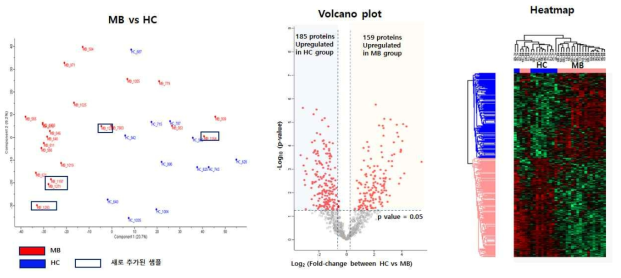 수두증 (hydrocephalus, 대조군)과 악성뇌암 (medulloblastoma) 환자 CSF protein 분석한 PCA score plot, volcano plot 및 heatmap