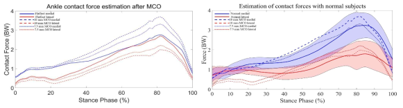 가상 내측 전위 종골 절골술 전과 7.5 mm, 10 mm 가상 내측 전위 종골 절골술 수행 후의 내외측 발목 접촉력 비교(왼쪽), 가상 내측 전위 종골 절골술 후 발목 내외측 접촉력 데이터(점선)와 정상인 10명의 발목 관절 내외측 접촉력 데이터(실선)의 비교(오른쪽)
