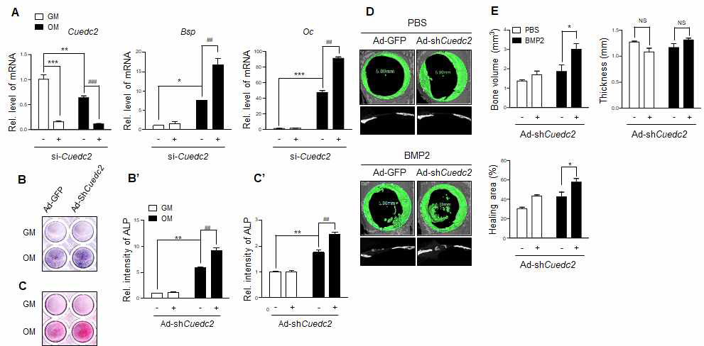 Suppression of Cuedc2 accelerates osteogenesis in vitro and in vivo. (A) Cells were transfected with si-Cuedc2 (+, 25 nM) or siRNA-Control (25 nM). After 24 h, cells were cultured with GM or OM for 4 days. Real-time PCR analysis was performed using Bsp-, Oc-, and Cuedc2-specific primers. *P < 0.05, **P < 0.01, ***P < 0.001 versus si-control of GM group. ##P < 0.01, ###P < 0.001 versus si-control of OM group. (B–C’) Cells were infected with Ad-GFP (50 MOI) or Ad-shRNA Cuedc2 (50 MOI) for 24 h. The infected cells were cultured under the same conditions as those mentioned in the legend of Fig. 2b-c’. (B) ALP staining. (B’) Intensity of ALP staining. (C) AR staining. (C’) Intensity of AR staining. **P < 0.01 versus Ad-GFP of GM group. ##P < 0.01 versus Ad-GFP of OM group. d, e Critical sized bone defect with a diameter of 5 mm was created using trephine bur. Ad-GFP (7 × 109 virus particle) or Ad-ShCuedc2 (7 × 109 virus particles) with PBS or BMP2 (500 ng) were implanted in punched calvarial bones of mice using an absorbable collagen sponge (n = 3). After 4 weeks, the calvarial bone was harvested and examined using microCT. (D) The panels on top display 3D images of regenerative bone (green). Bottom panels display the sagittal view of the calvarial bone. (E) Volume, thickness, and healing area of regenerated bone were measured using the CTan program. *P < 0.05 versus Ad-GFP with BMP2 group