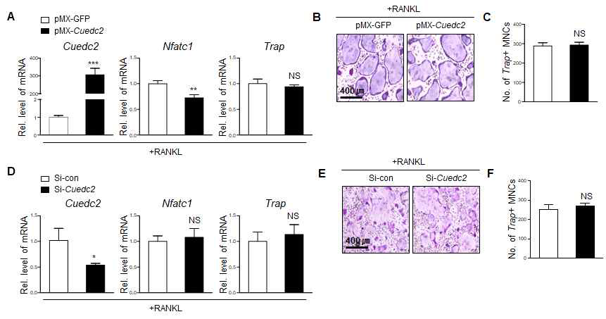 Effects of Cuedc2 on osteoclast differentiation. (A–C) Bone marrow macrophages were infected with pMX-IRES-EGFP (pMX-GFP) or Cuedc2 retrovirus and the cells then cultured with M-CSF (30 ng/ml) and RANKL (100 ng/ml) for 3 days. (A) Total RNA was extracted from the cultured cells and then real-time PCR was performed using Cuedc2-, Nfatc1-, and Acp5(Trap)-specific primers. **P < 0.01, ***P < 0.001 versus pMX-GFP. (B) The cells were stained for Trap. (C) The number of Trap-positive multinucleated cells (MNCs) per well was counted. (D-F) BMMs were transfected with siRNA control or si-Cuedc2 (25 nM). After 24 h, cells were cultured for 3 days in the presence of M-CSF (30 ng/ml) and RANKL (100 ng/ml). (D) Real-time PCR analysis. *P < 0.05 versus si-control. (E) Trap staining. (F) The number of Trap-positive multinucleated cells