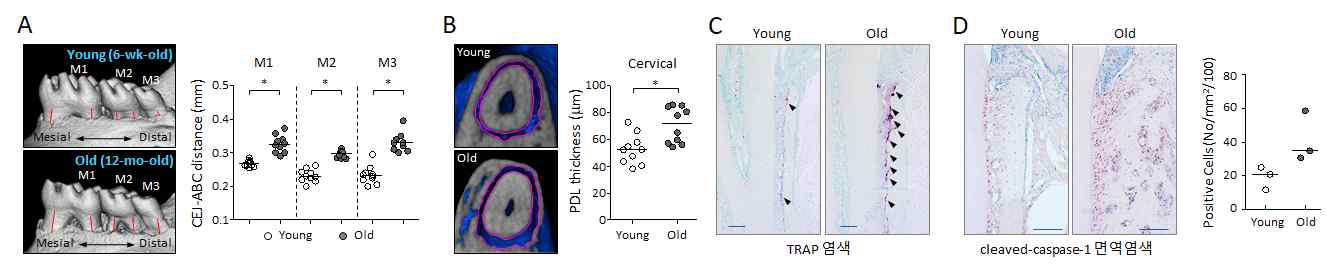 나이에 따른 치조골 소실 증가. (A) 마우스 대구치 부위에서 CEJ-ABC 거리를 측정하여 그 수치를 그래프화한 결과. (B) 마우스 치주인대강의 폭을 측정하고 그 수치를 그래프화한 결과. (C) 마우스 치아 주변 조직 절편을 TRAP 염색하여 파골세포의 분포를 동정한 결과. (D) 마우스 치아 주변 조직 절편을 면역염색하여 cleaved-caspase-1 발현 세포를 동정하고 그 수치를 그래프화한 결과