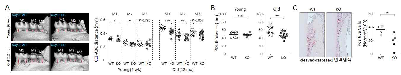 NLRP3 KO 마우스에서 월령별 치조골 변화. (A) 각각의 그룹에서 치아 CEJ-ABC 거리를 측정하고 그 수치를 그래프화한 결과. (B) 치주인대강의 폭을 측정하고 그 수치를 그래프화한 결과. (C) 12개월령 NLRP3 WT와 KO 마우스의 치아 주변 조직 절편에서 cleaved-caspase-1 발현 세포의 분포를 동정하고 그래프로 표현한 결과(면역조직염색)