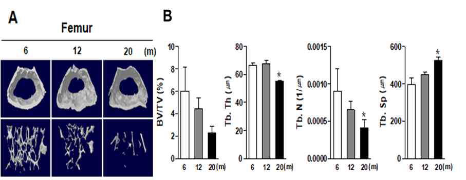 Changes of bone tissue in aged mice. (A) Representative micro-CT images of the proximal tibia at 6, 12, and 20 month old mice. (B) Bone parameter analysis for bone volume per tissue volume (BV/TV), trabecular thickness (Tb.Th), trabecular number (Tb.N) and trabecular separation (Tb. Sp)