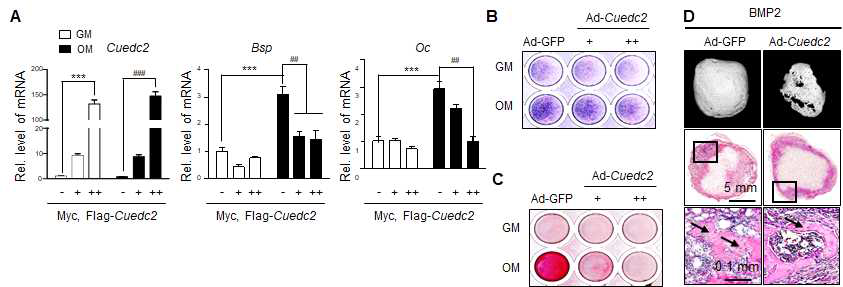 Overexpression of Cuedc2 inhibits osteogenesis in vitro and in vivo. (A) Cells were transfected with Myc-Flag tagged Cuedc2 (+, 500 ng; ++, 1000 ng) or empty vector and cultured for 4 days in GM (growth medium) or OM (osteogenic medium). Real-time PCR was performed with Cuedc2-, Bsp-, and Oc-specific primers. (B, C) Cells infected with Ad (adenovirus)-GFP (100 MOI) or Ad-Cuedc2 (+, 50 MOI; ++, 100 MOI). (B) After infection, the cells were cultured with GM or OM for 5 days and stained with BCIP/NBT solution for alkaline phosphatase (ALP) staining. (C) The infected cells were cultured for 12 days under the conditions shown in the Fig. 2B. And then alizarin red (AR) staining was performed. (D) Ad-GFP (1 × 1010 virus particles) or Ad-Cuedc2 (1 × 1010 virus particles) with BMP2 (3 μg) were implanted in a subcutaneous pocket on the backs of the mice using an absorbable collagen sponge (n = 3). After 4 weeks, mice were sacrificed and evaluated radiologically or histologically