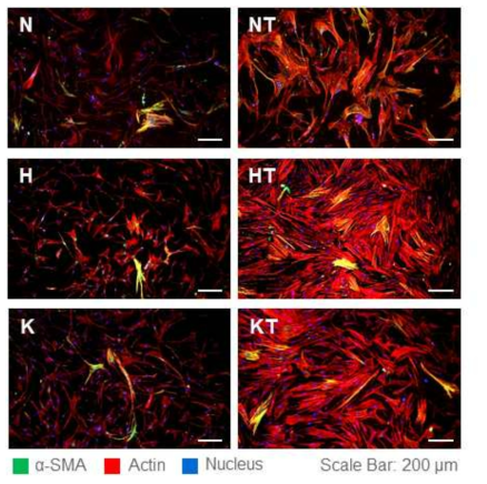 인장 자극에 반응하여 actin stress fiber가 많이 생긴 세포들의 형광면역염색 사진