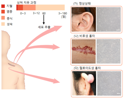 각 흉터의 성숙단계에서 추출된 섬유아세포 사진(scale bar : 200 μm)