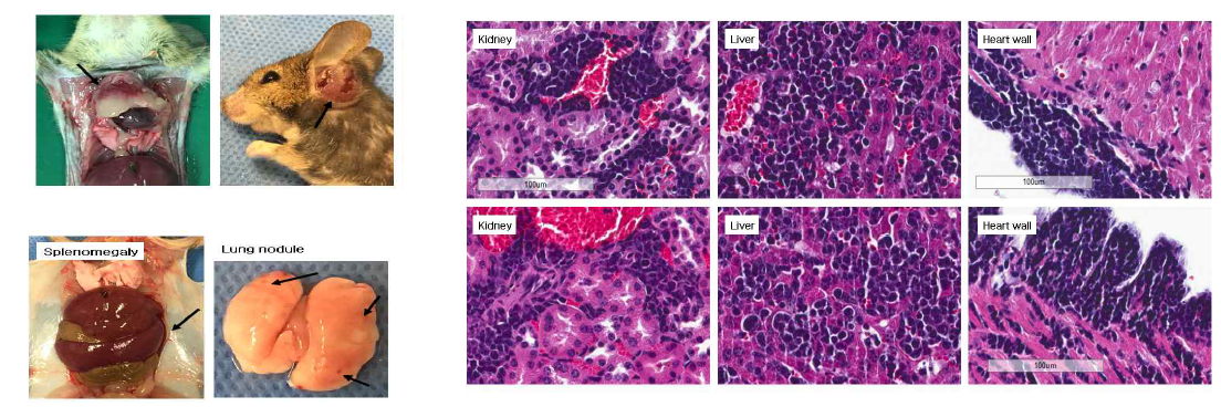 VECre;P53fl/fl model에서의 radiation-induced angiosarcoma