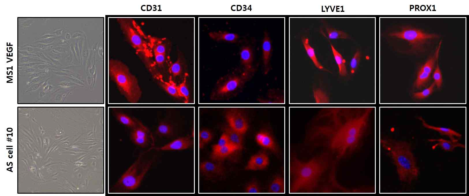 췌장 혈관 육종 세포와 VECre;P53fl/fl 모델 유래 혈관 육종 세포에서 endothelial cell marker-CD31, CD34와 혈관 육종 maker-LYVE1, PROX1의 발현을 확인