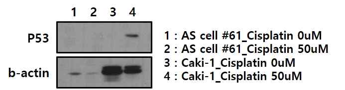 P53 induction을 위해 일차 배양된 혈관 육종 세포와 정상 P53 발현을 지닌 세포주에 cisplatin treatment를 진행
