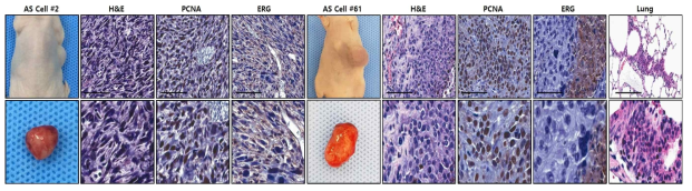 면역 결핍 마우스에 일차 배양된 마우스 혈관육종세포 SC 주입을 통해 in vivo 종양 형성 및 전이능 검증