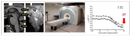 초고자장 MRI에서의 초고해상도 뇌영상 및 3T 이상에서 가돌리늄 조영제의 효율 감소