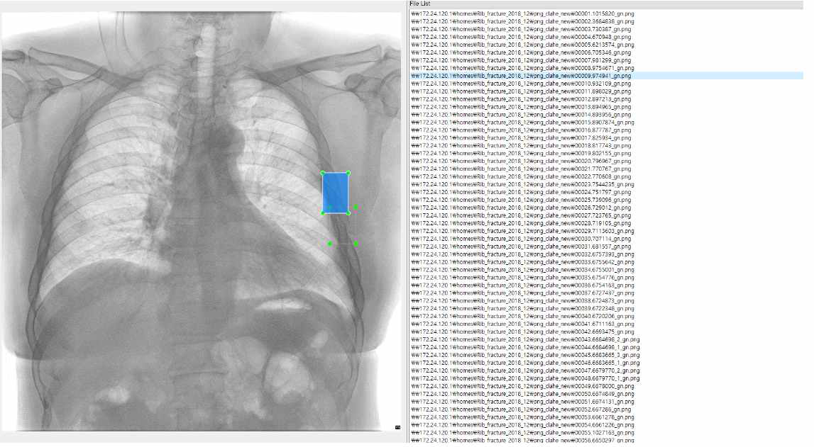 영상에 늑골 골절 부위를 box 형태로 표시한 데이터베이스 user interface 화면 캡쳐