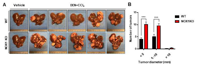 (A) Representative images of the livers. (B) Numbers of tumors according to tumor diameter in DEN+CCl4 injected mice. Liver tissues were obtained at 4 weeks after the last CCl4 injection