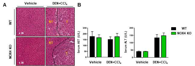 (A) Representative images of liver sections that are stained with H&E from vehicle or DEN+CCl4 injected mice . (B) Serum AST and ALT levels. Serum was obtained at 4 weeks after the last CCl4 injection