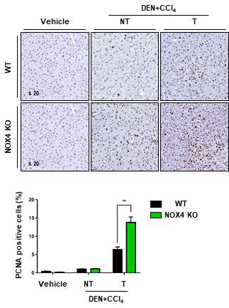 Representative staining images of proliferating cell nuclear antigen (PCNA) (up), and percentages of positive-stained cells (bottom)