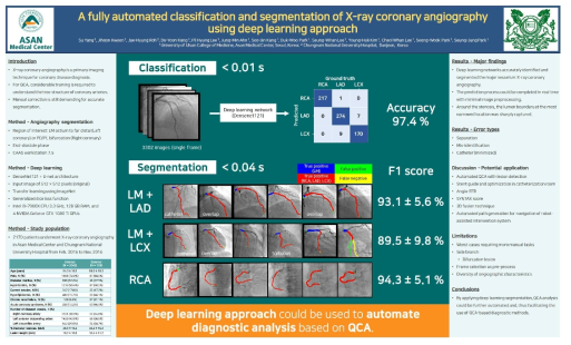 좌주간지 (left main coronary artery)를 포함한 혈관조영술 분할