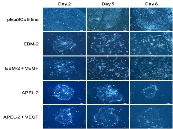 Morphology of porcine epiblast stem cells (pEpiSCs) cultured in differentiation media