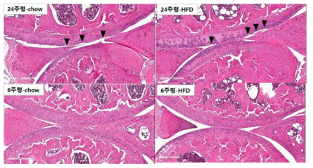 무릎 조인트 부분의 HE histology 이미지