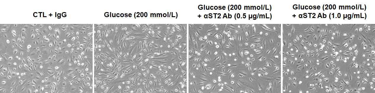 고농도 포도당을 이용한 HPMC 섬유화 모델과 anti-ST2 Ab의 효과