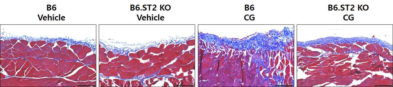 chlorhexidine 유발 복막섬유화 마우스 모델과 ST2 KO 마우스의 효과