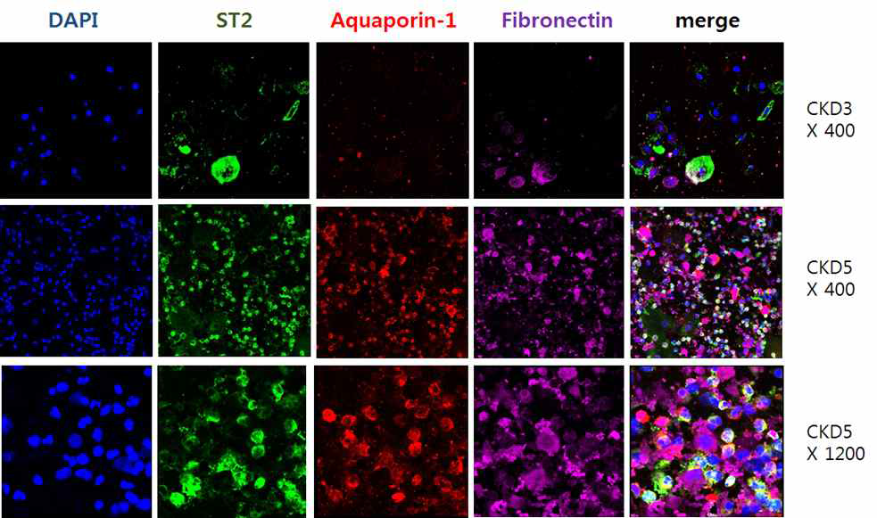 인체 소변 세포에서 ST2, aquaporin-1, fibronecin의 발현 비교