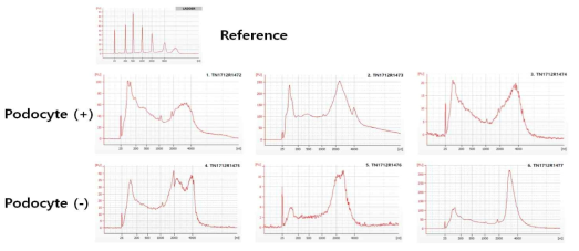 인체 소변 시료에서 RNA sequencing 이전 bioanalyzer를 통한 QC report