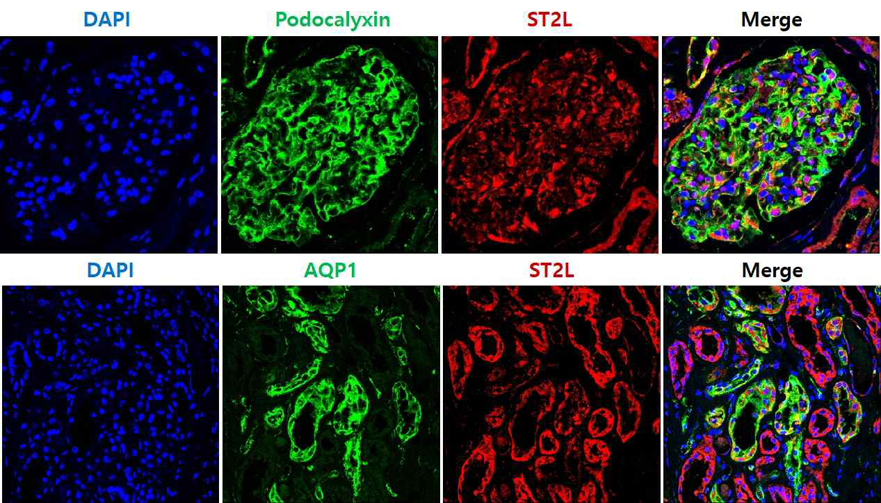 CKD 5 환자들의 신장조직에서 podocalyxin+ST2+cell과 aquaporin-1+ST2+cell 확인