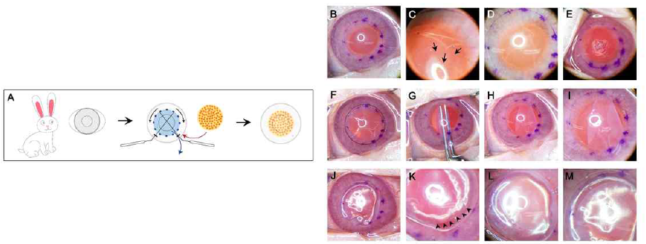 Illustrated and optical images showing surgical steps for transplantation of 3D bioprinted corneal endothelial graft in rabbit corneas. (A) Schematic illustration of Descemet’s membrane peeling in a rabbit cornea followed by transplantation of HCEC grafts 3D-printed on amniotic membrane (AM). (B-M) Representative images taken during the surgery. After central circle with 8-mm diameter was marked (B), Descemet membrane was peeled off using reversed Sinskey hook and was extracted (C-E). The extracted Descemet’s membrane is noted (E) after peeling toward the center of cornea (C, arrows). The graft sheet cut into 8mm diameter circle (F, inside the dotted circle) was folded and inserted into anterior chamber using intraocular lens (IOL) insertion forcep (G). After graft was unfolded (H,I), the 2.75-mm-sized corneal wound was sutured with #10-0 nylon and air was injected to attach the graft sheet to the corneal stroma (J-M). It is noted that the margin of inserted graft well-attached at the inner surface of cornea by air in anterior chamber (K, arrow heads)