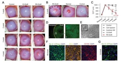 In vivo corneal endothelial regeneration after transplantation of 3D bioprinted corneal endothelial grafts in rabbit corneas and ex vivo histologic observation of the transplanted graft 4 weeks after surgery