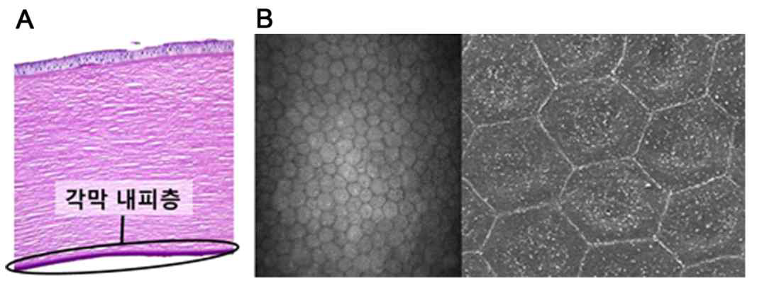 (A) 정상 각막의 조직 소견. (B) 육각형의 정상 각막내피 세포의 모습
