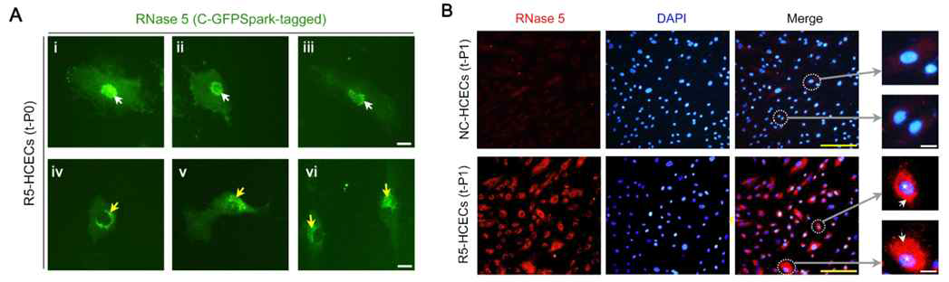 RNase 5 plasmid DNA transfection 후, 배양된 인간 각막 내피 세포 (HCEC)에서의 세포 내 RNase 5 단백질의 발현 확인