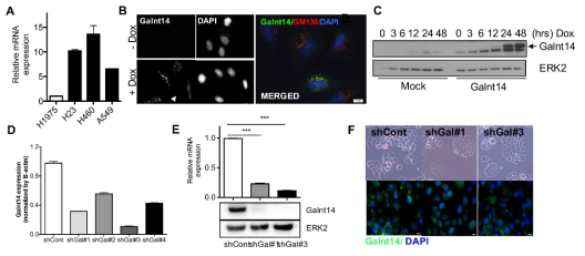 GALNT14 발현 조절 세포주 확립 (A) 폐암 세포주에서 GALNT14 발현 비교 (B) H1975세포주에 GALNT14 DOX inducible 세포주 확립 후 GALNT14 발현 확인 (C) 면역블랏팅을 통한 DOX 처리 시간에 따른 GALNT14 발현 (D)GALNT14 shRNA 가 도입된 H460 세포주에서 GALNT14 발현 확인 (E) GALNT14 발현 억제 효율이 높은 세포주에서 GALNT14 의 발현을 real-time PCR과 면역 블랏팅으로 확인 (F) GALNT14 Knockdown 세포주의 형광 현미경 image