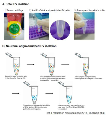 랫드 혈청에서 세포외소포체의 분리와 신경유래 엑소좀의 분리 방법