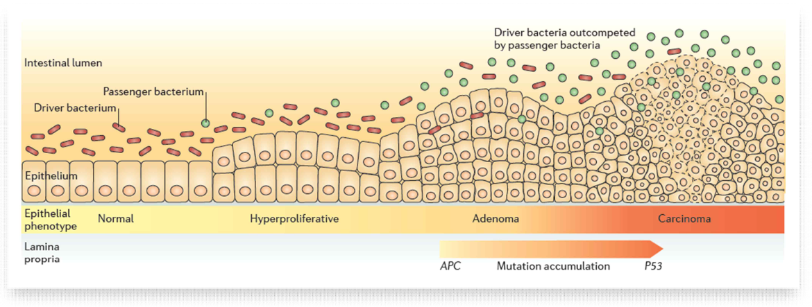A bacterial driver-passenger model for colorectal cancer