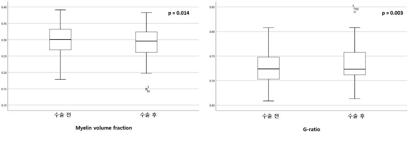 수술 전후 거대뇌하수체 종양환자에서 myelin volume fraction 및 g-ratio 비교