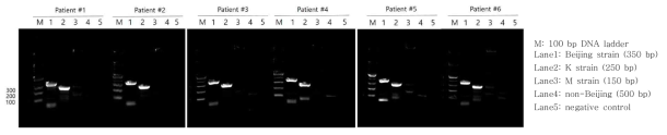 환자에서 분리된 임상균주의 M. tb genotypes