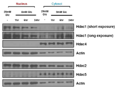 Astrocyte 배양 중 media 내의 Glucose 농도를 조절 했을 때 핵 및 세포질의 HDAC 1,2,4 및 5 단백질 변화량