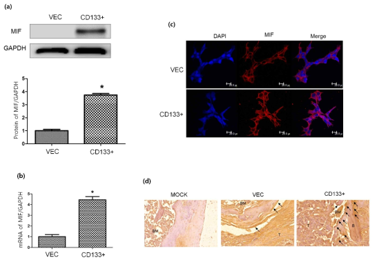 In vitro and in vivo expression of macrophage migration inhibitory factor (MIF) in LNCaPVec and LNCaPCD133+cells. (a) The expression of MIF in LNCaPVec(Vec)andLNCaPCD133+(CD133+)cells