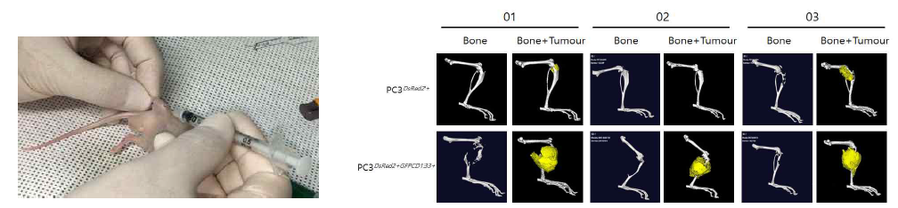 PC3wild/PC3CD133+과 DU145wild/DU145CD133+세포주 접종한 Tibia에서 종양 형성에 따른 골절소견 : 3주째에서 PC3CD133+및 DU145CD133+세포주 접종한 Tibia에서 전이성 골종양의 형성 관찰
