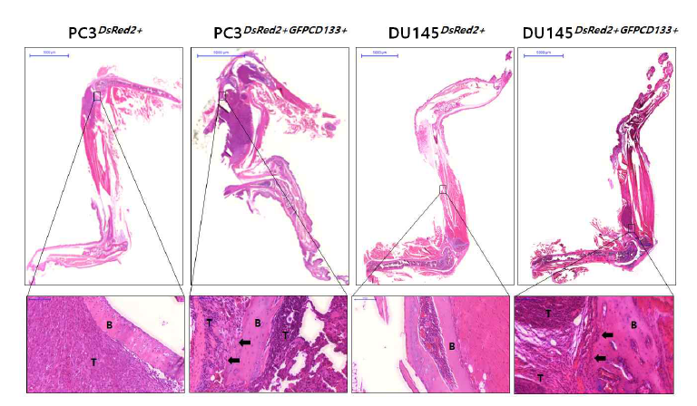 PC3wild/PC3CD133+과 DU145wild/DU145CD133+세포주 접종한 Tibia에서 종양 형성 관찰