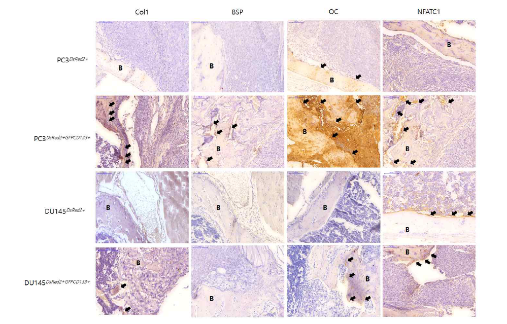 PC3wild/PC3CD133+과 DU145wild/DU145CD133+세포주 접종한 Tibia bone marrow에서 Osteogenic/Ostolytic marker 발현을 Immunohistochemical study를 통해서 확인함