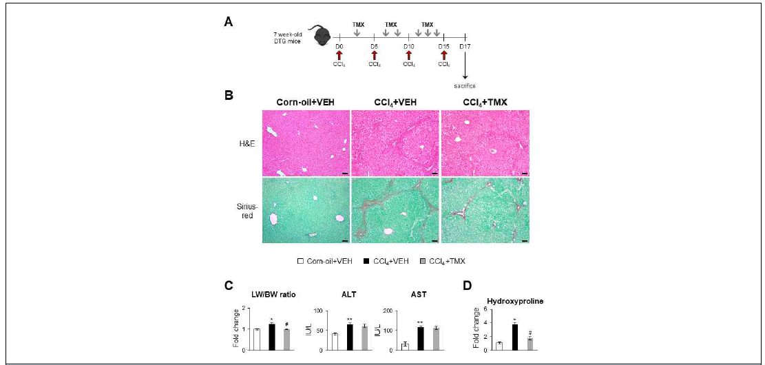 TMX에 의해 CCl4 유도 간손상 및 간섬유화 정도의 완화