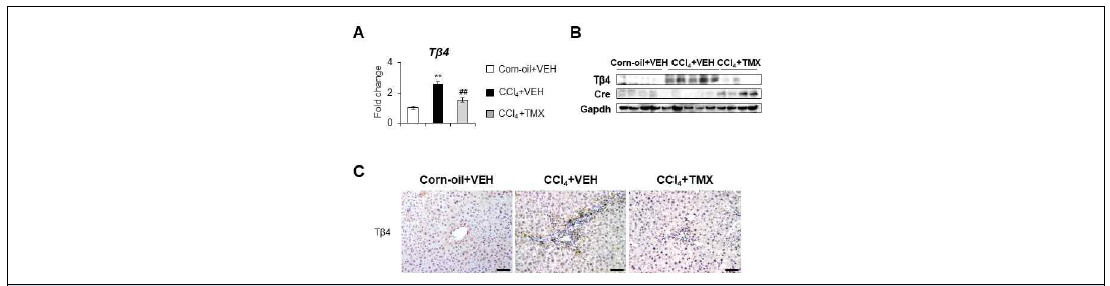 CCl4 모델에서 TMX에 의한 간 내 Tβ4의 발현 감소