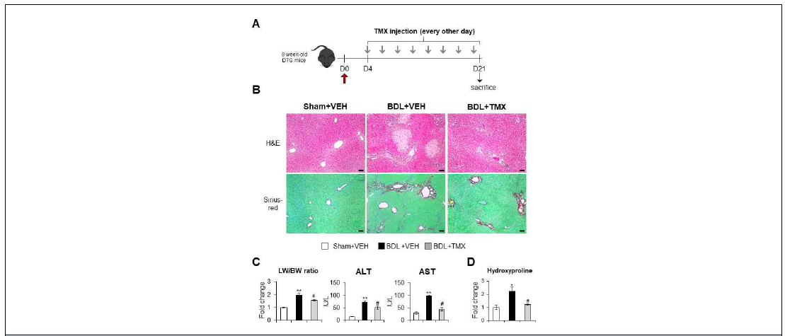 TMX에 의해 BDL 유도 간손상 및 간섬유화 정도의 완화
