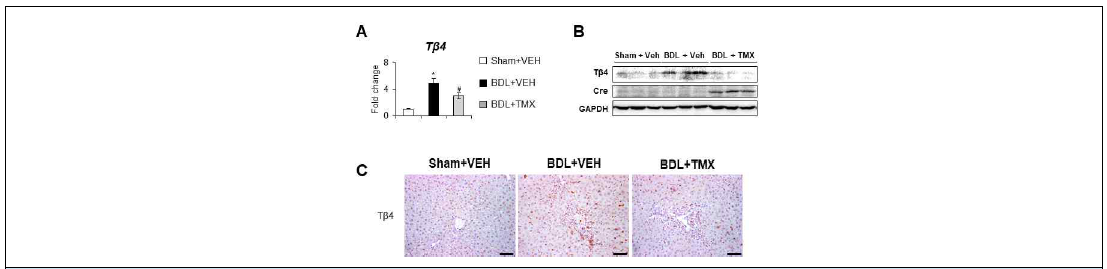 BDL 모델에서 TMX에 의한 간 내 Tβ4의 발현 감소