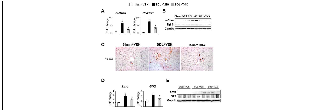 BDL 모델에서 관찰된 TMX에 의한 간성상세포의 활성 억제