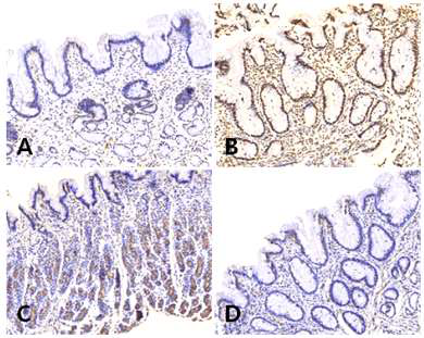 0.1% M.B 처리한 위점막 TUNEL 염색 (A) 조사 전 (B) 조사 직후 (C) 조사 후 3시간 (D) 조사 후 10시간