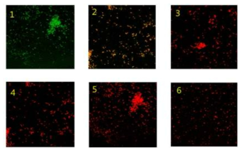 공초점 현미경(confocal microscopy)을 활용한 C. difficle의 사멸 확인결과 항생제 농도 0.2 mg/ml, 조사시간 30분, 1. 대조군, 2. UVA+chitosan 3. UVA+TC+chitosan 4. UVA+DXY+chitosan 5. UVA+MIN+chitosan 6. UVA+TGE+chitosan