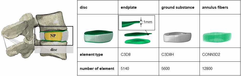 척추, 디스크 등을 세부 모사한 상체 유한요소모델